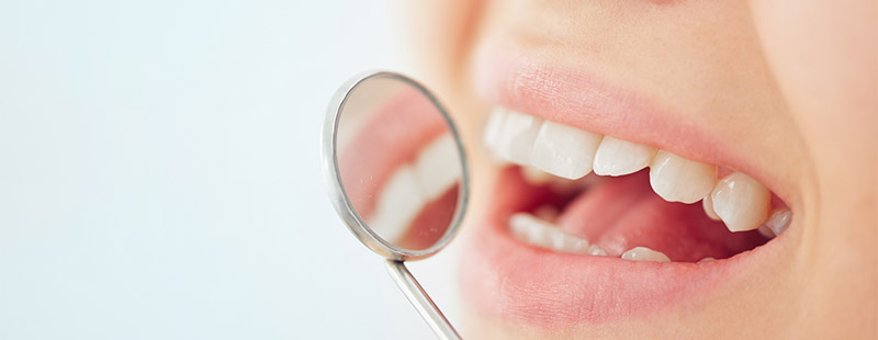 Ein Bild in dem eine Person den Mund öffnet und ein kleiner Spiegel an den Mund gehalten wird